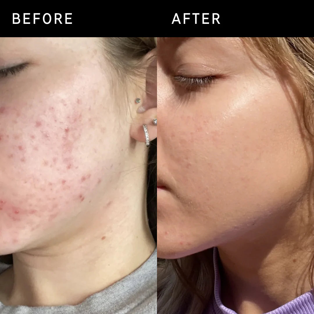 The INKEY List Niacinamide Serum