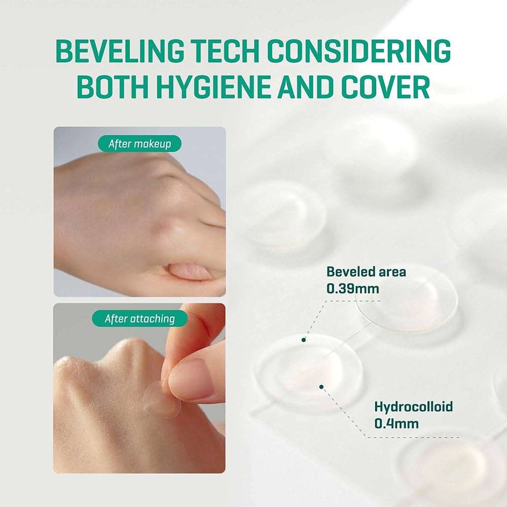 Some By Mi 30 Days Miracle Clear Spot Patch
