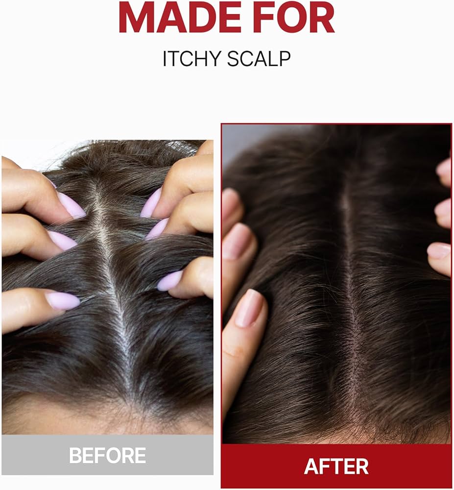 Kundal Caffeine Hair Loss Scalp Tonic