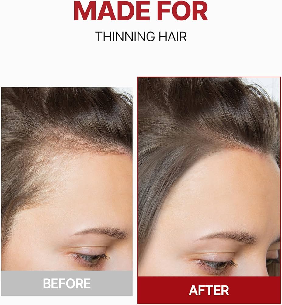 Kundal Caffeine Hair Loss Scalp Tonic