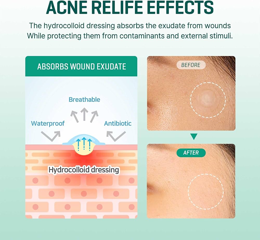 Some By Mi 30 Days Miracle Clear Spot Patch