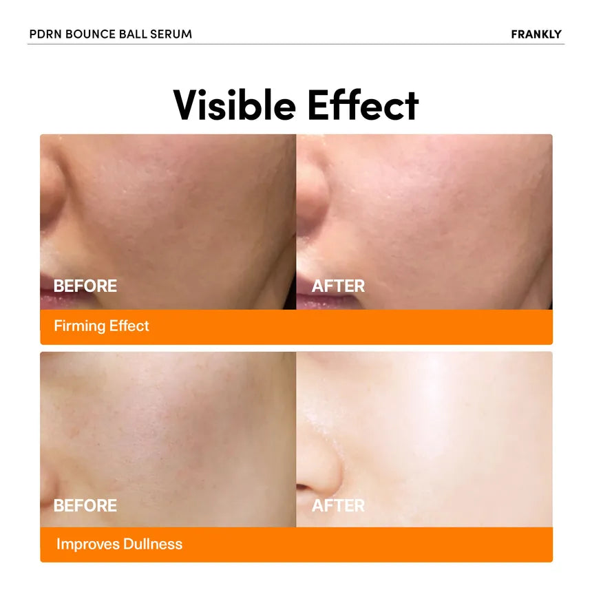 FRANKLY PDRN Bounce Ball Serum